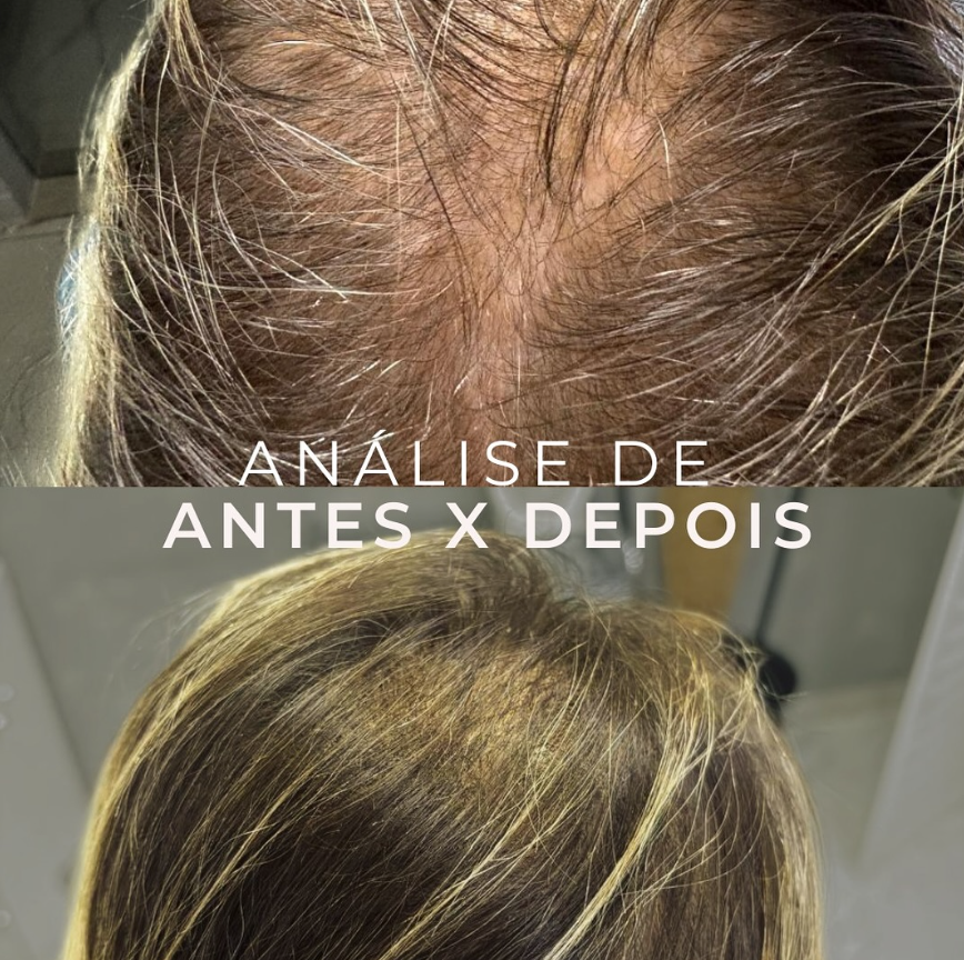 Antes e Depois - Caso 1